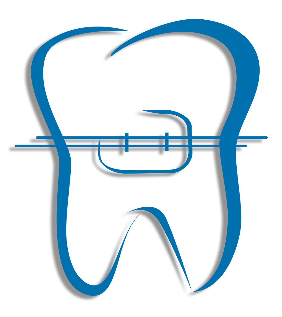 Brackets - Kieferorthopädie